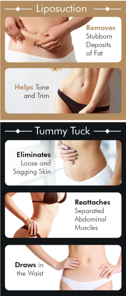 Should I Get A Tummy Tuck Or Liposuction? Tummy Tuck vs Liposuction. Absolutely Adell